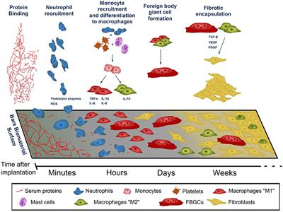 Foreign Body Reaction to Implanted Biomaterials and Its Impact in Nerve Neuroprosthetics